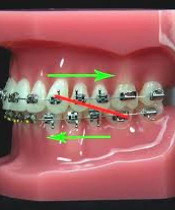Orthodontics II	